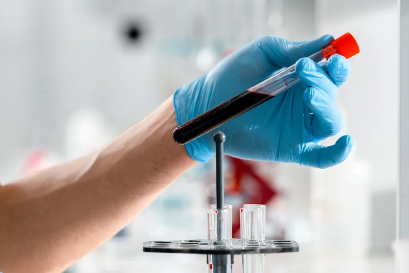 What Your Day 21 Progesterone Result Actually Tells You About Your Clomid Cycle